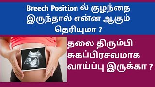 Breech Position of baby during pregnancy in Tamil  when baby fix in cephalic position in tamil [upl. by Baer]