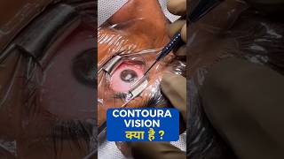 What Is Contoura vision [upl. by Etram]