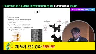 Fluoroscopy guided spine injection Feat Ultrasound guide [upl. by Anni]