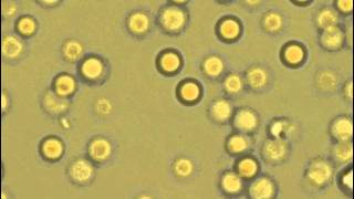 Lysis of erythrocytes in the hypotonic buffer [upl. by Neelak]