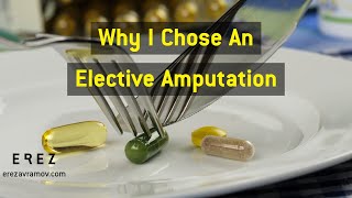 Why I Chose An Elective Amputation part 1 of 17 [upl. by Assirolc340]