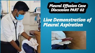 Pleural EffusionCase Discussion PART 02 Pleural Aspiration live Demonstration [upl. by Ferree333]