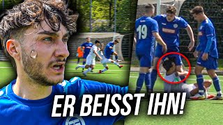 KREISLIGA SPIEL ESKALIERT VÖLLIG UNSER SPIELER WIRD GEBISSEN [upl. by Inaluiak]