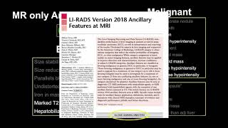 9 LIRADS Ancillary Features  Part 1 By Dr James Lee [upl. by Harty]