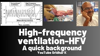 High frequency ventilation l A review of its background [upl. by Auhoj]