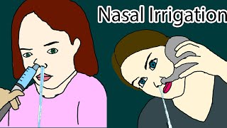 Nasal Irrigation  how to do nasal irrigation Nasal Rinse [upl. by Ymeon]