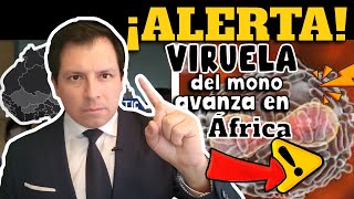 ALERTA⚠️ VIRUELA DEL MONO AVANZA EN ÁFRICA [upl. by Lesna]