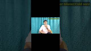 Fever blistersCold sore treatment medicine ointment shorts ytshorts drniteshraj [upl. by Imoyaba578]