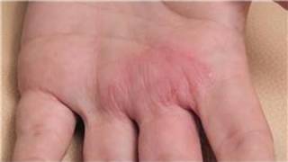 Dermatology Treatments  How to Diagnose Skin Rashes [upl. by Eimmot105]