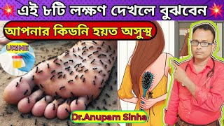 💥এই ৮টি লক্ষণ দেখলেই বুঝবেন আপনার কিডনি খারাপ হতে শুরু হয়েছে। Early Signs Of Kidney Disease [upl. by Adym]