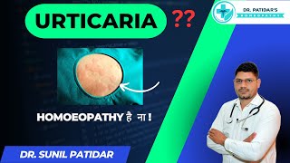 quotRelief from Urticaria Homeopathic Medicine by Dr Sunil Patidarquot [upl. by Sorcim]