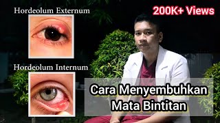 Obat mata bintitan  Hordeolum dan Kalazion [upl. by Animrac]