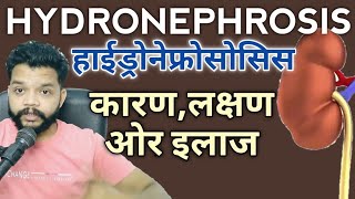 Hydronephrosis Kya Hota Hai  CausesSymptomsDiagnosisTreatment in Hindi  Kidney Disease [upl. by Isac123]