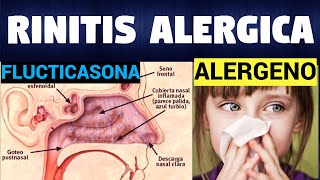 TODO SOBRE RINITIS ALERGICA  Síntomas Diagnostico y Tratamiento [upl. by Fernald523]