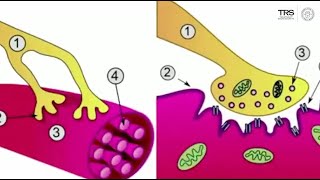 What are Trigger Points [upl. by Shig]