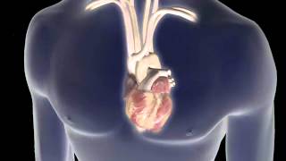 Atrial Fibrillation AFib Animation [upl. by Haidabej]