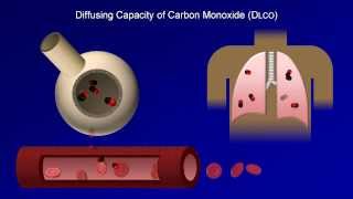 Pulmonary Function Tests PFT Lesson 4  DLCO [upl. by Ignatius]