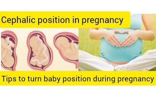 Cephalic presentation in tamilbaby positiontips to turn baby head down positionpregnancy tips [upl. by Wichman636]