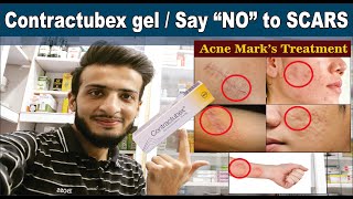 Contractubex gel  Get rid of SCARS Quickly  Uses amp Sid effects  Acne Scars Treatment  O Beauty [upl. by Fawne]