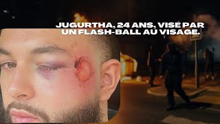 Jugurtha 24 ans visé par un tir de flashball au visage pendant les révoltes à RueilMalmaison [upl. by Retsek261]