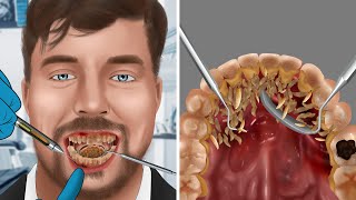 Help MrBeast Be careful with tooth decay and gingivitis  WOW Brain Relax [upl. by Laris]