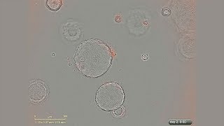 Growth of Mouse Pancreatic Organoids in PancreaCult™ Culture Medium Under a Microscope [upl. by Euqilegna]