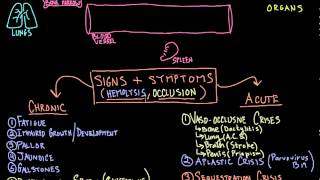 Gene Mutations and Sicklecell Anemia IB Biology [upl. by Anagrom]