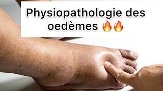 📍 Physiopathologie des Oedèmes par khadidja ferdj 🔥 [upl. by Ruddy]