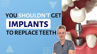 Dont Get Screwed Heres Why You Shouldnt Get Dental Implants [upl. by Aimit22]