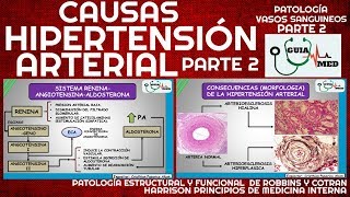 SINTOMAS DE HIPERTENSIÓN ARTERIAL FISIOPATOLOGÍA PARTE 2  GuiaMed [upl. by Einhapets747]