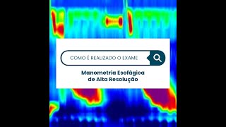 Manometria Esofágica de Alta Resolução Entenda como é feito [upl. by Saxen302]