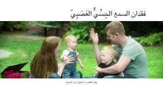 Sensorineural Hearing Loss Arabic  فقدان السمع الحِسِّيٌّ العَصَبِيّ [upl. by Yrakcaz]