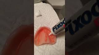 Denture adhesive how to video [upl. by Ijar759]