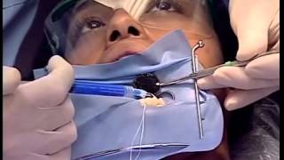 Chair Side Dental Assisting Training Video for Dental Staff [upl. by Tallu]