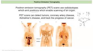 Chem 121 Lecture 10 D Radioisotopes in Medicine [upl. by Anirtak135]