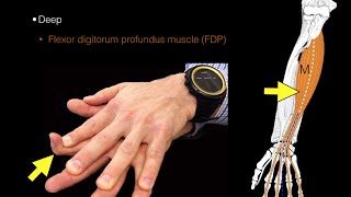 Forearm flexor muscles [upl. by Jd]