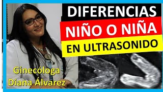 Â¿cÃ³mo se ve si es NIÃ‘O o NIÃ‘A por ULTRASONIDO SEMANA 12 A 20 por GINECOLOGA DIANA ALVAREZ [upl. by Mcnally]