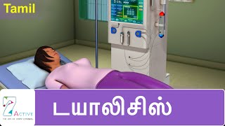 DIALYSIS  Tamil [upl. by Holton]