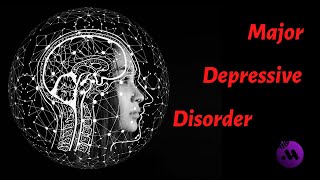 Major depressive disorder MDD  DSM5 diagnostic criteria  Symptoms [upl. by Dorca413]