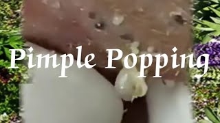 Pimple amp Blackheads Popping  24 [upl. by Berneta]