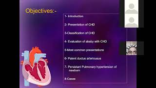 Approach of CHD in newborn and infants by Dr Ahmed Fawzy [upl. by Dieball]