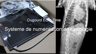 Numeriseur de radiologie passer en numérique [upl. by Ferretti]