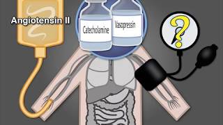 Treating Vasodilatory Shock [upl. by Llirrehs]