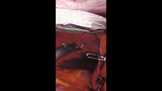 Mesh sewing during robotic ventral hernia repair shorts [upl. by Oal]