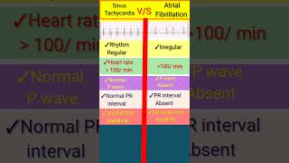 Difference between sinus Tachycardia and Atrial fibrillation ECG lshorts ecg [upl. by Greenfield252]