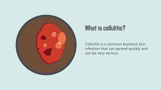 Cellulitis Causes Symptoms Diagnosis and Treatment  Merck Manual Consumer Version Quick Facts [upl. by Severn508]