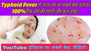 Typhoid fever causessymptomstestdiet and full treatment मोतीझरा का इलाजलक्षण कारणजांचे परहेज। [upl. by Rehtul399]