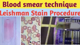 PERIPHERAL BLOOD SMEAR  HAEMATOLOGY LAB  LEISHMAN STAIN PHYSIOLOGY PRACTICALS [upl. by Domela94]