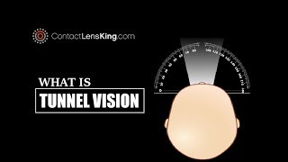 Whats Tunnel Vision Symptoms and Loss of Peripheral Vision [upl. by Nyletak]