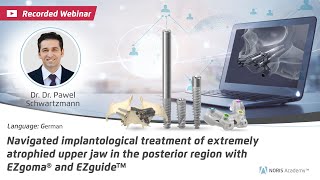 WebinarNavigated implantological treatment of extremely atrophied upper jaw in the posterior region [upl. by Stanfield]